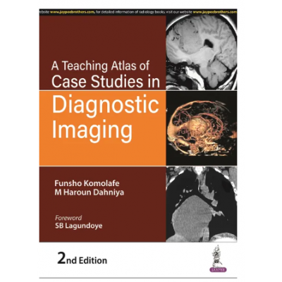 Diagnostic Imaging: Brain 3rd Edition 2016 By Osborn